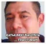 Raymundo Bautista……….... Fracturan 