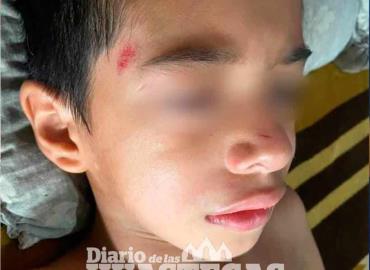 Niño fue arrollado por un motociclista
