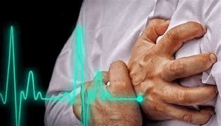 Covid-19 incrementó muertes por infartos