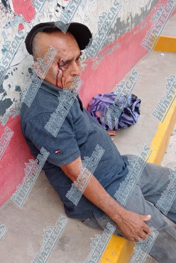 En la Santa Irene: Hombre herido al caer de su altura