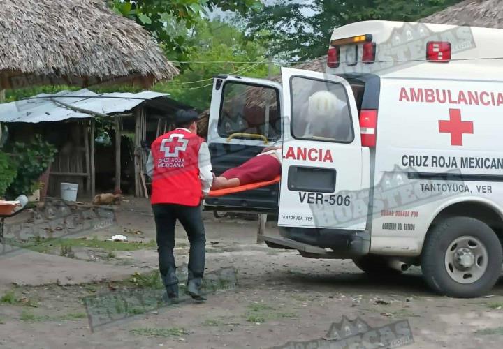 Auto embistió a mujer mayor