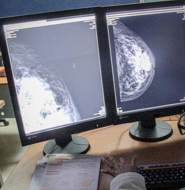 La SSH recomienda revisiones periódicas para la detección oportuna de cáncer de mama y cuello uterino