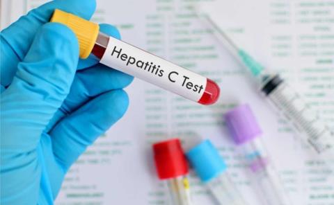 Alerta por hepatitis A
