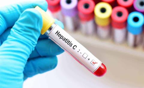 ALERTA POR HEPATITIS C