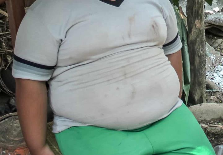 Identificados en Hidalgo, más de 4 mil menores con sobrepeso y obesidad