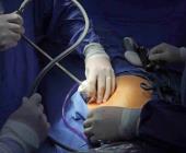 Operan cirujanos estéticos patito