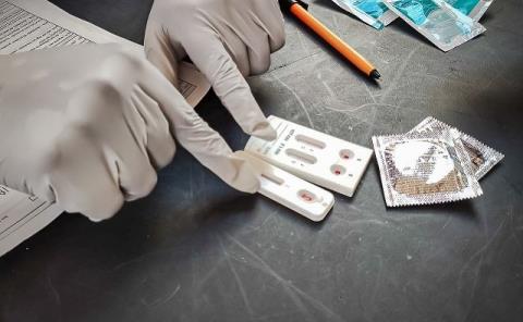 SSH dispone de pruebas de detección rápidas para VIH
