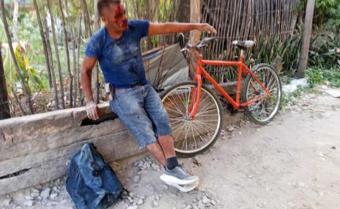 Borracho albañil derrapó en "bici"