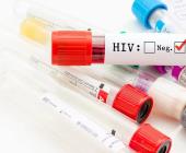 Logran eliminar el VIH
