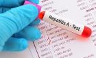 Confirman 50 casos de hepatitis este año