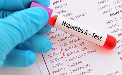 Confirman 50 casos de hepatitis este año